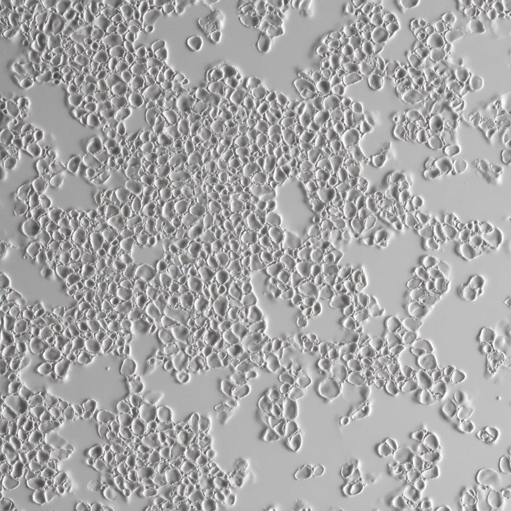 Immortalized Endothelial Cells