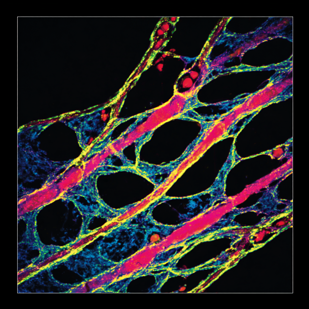 Human Coronary Artery Endothelial Cells
