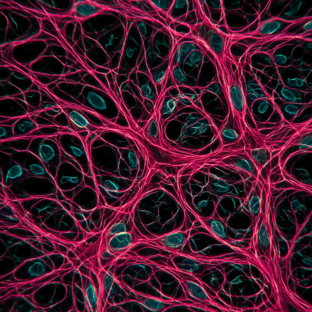 Human Dermal Lymphatic Microvascular Endothelial Cells