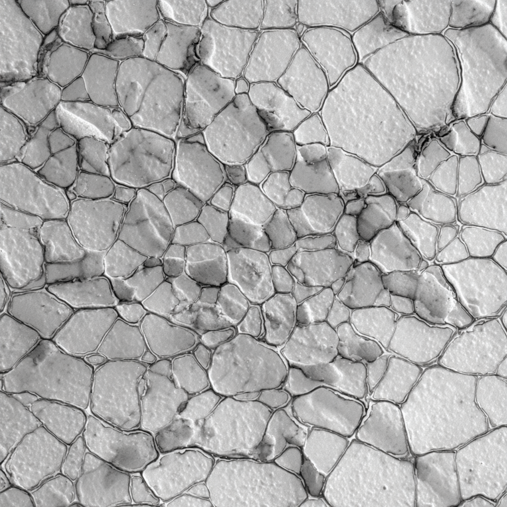 Human Internal Mammary Artery Endothelial Cells
