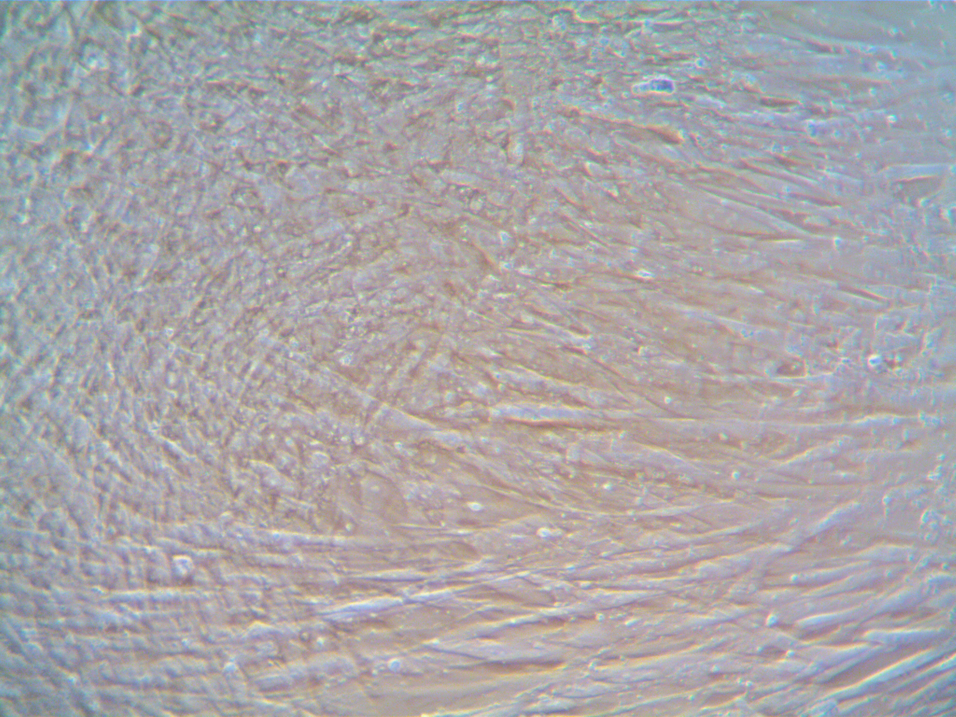 hTERT Human Lung Cancer-Associated Fibroblasts (CAF) – Adenocarcinoma