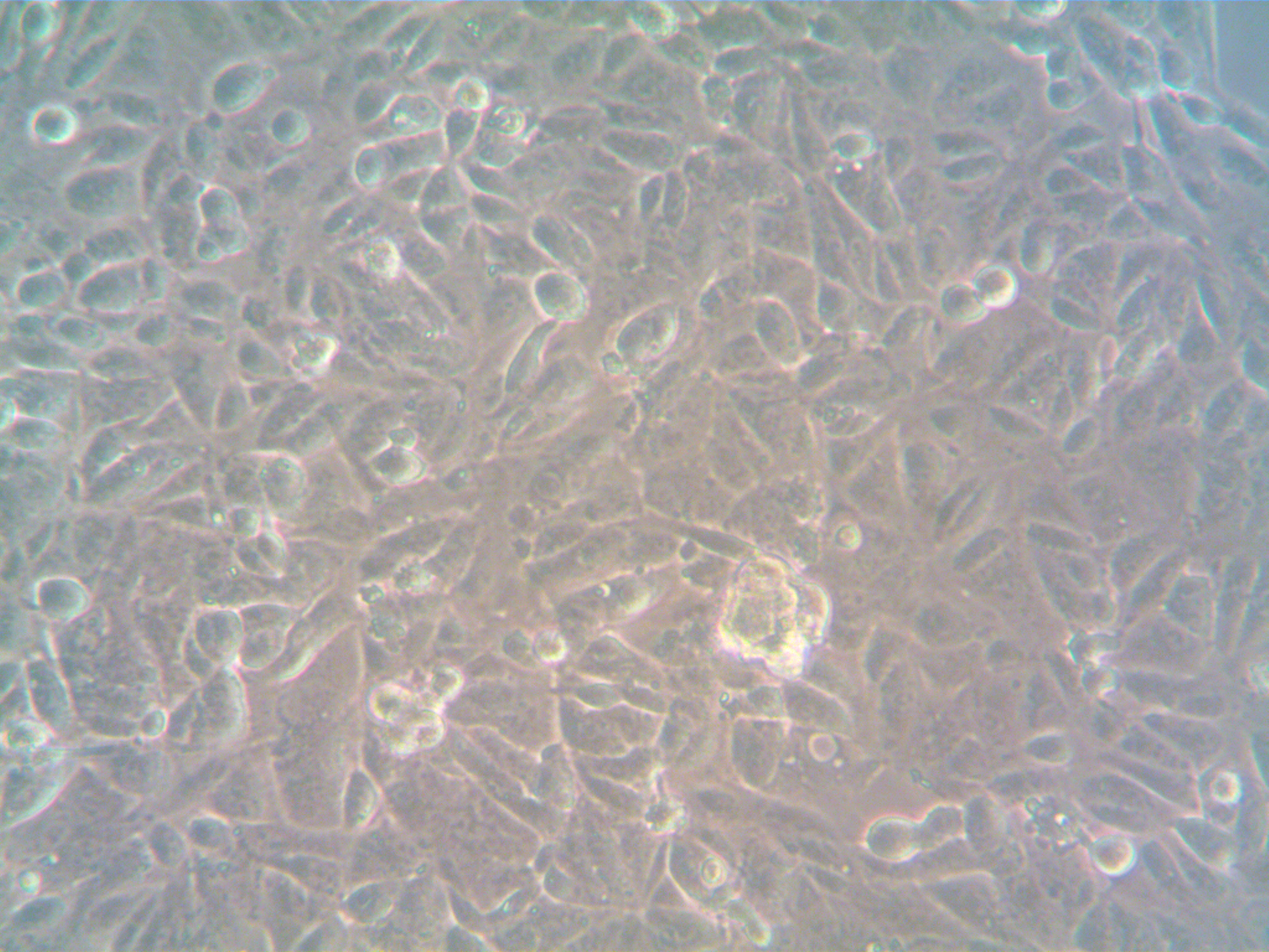 hTERT Human Ovarian Cancer-Associated Fibroblasts (CAF)