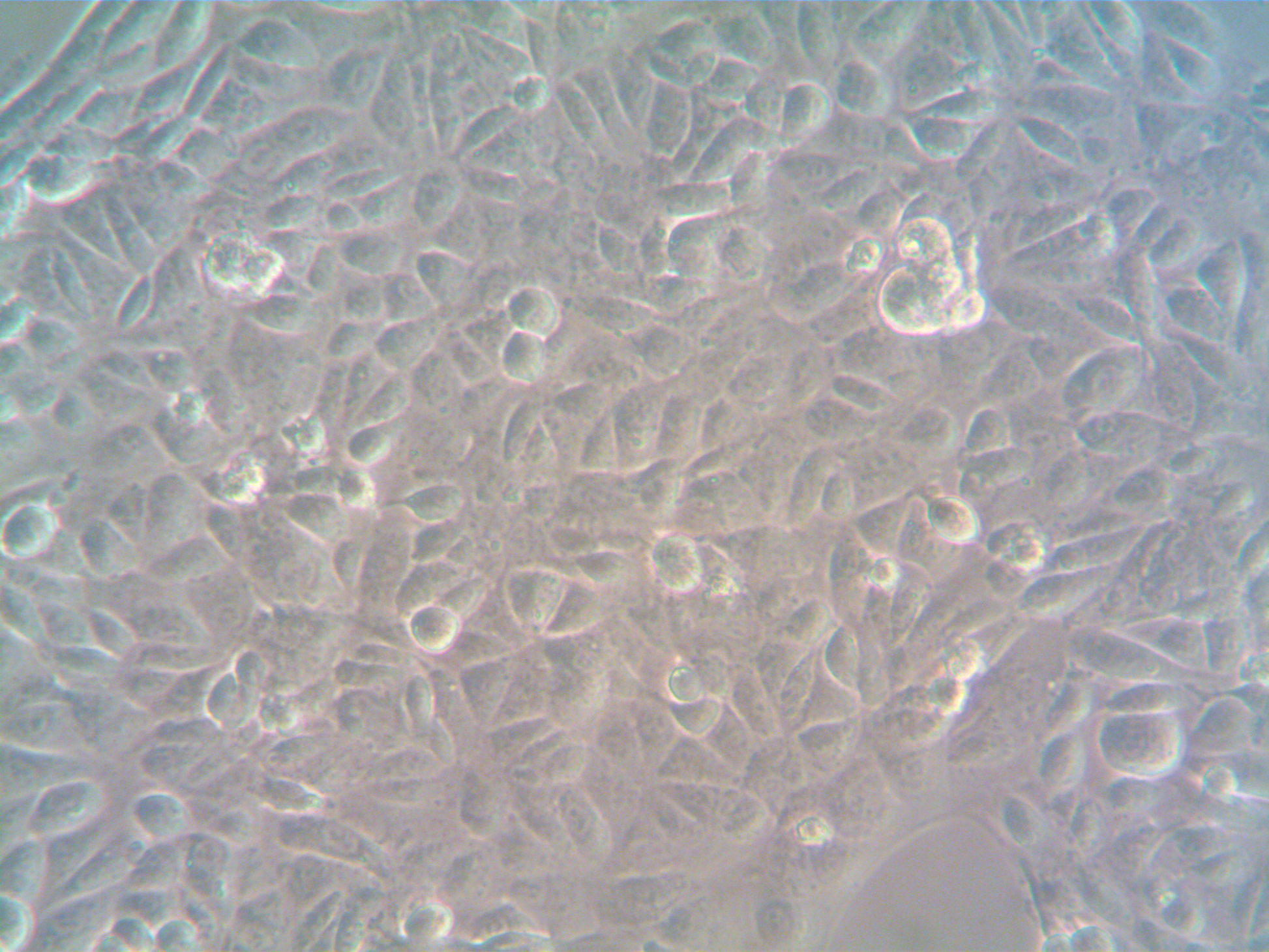 hTERT Human Metastatic Ovarian Cancer-Associated Fibroblasts (CAF)