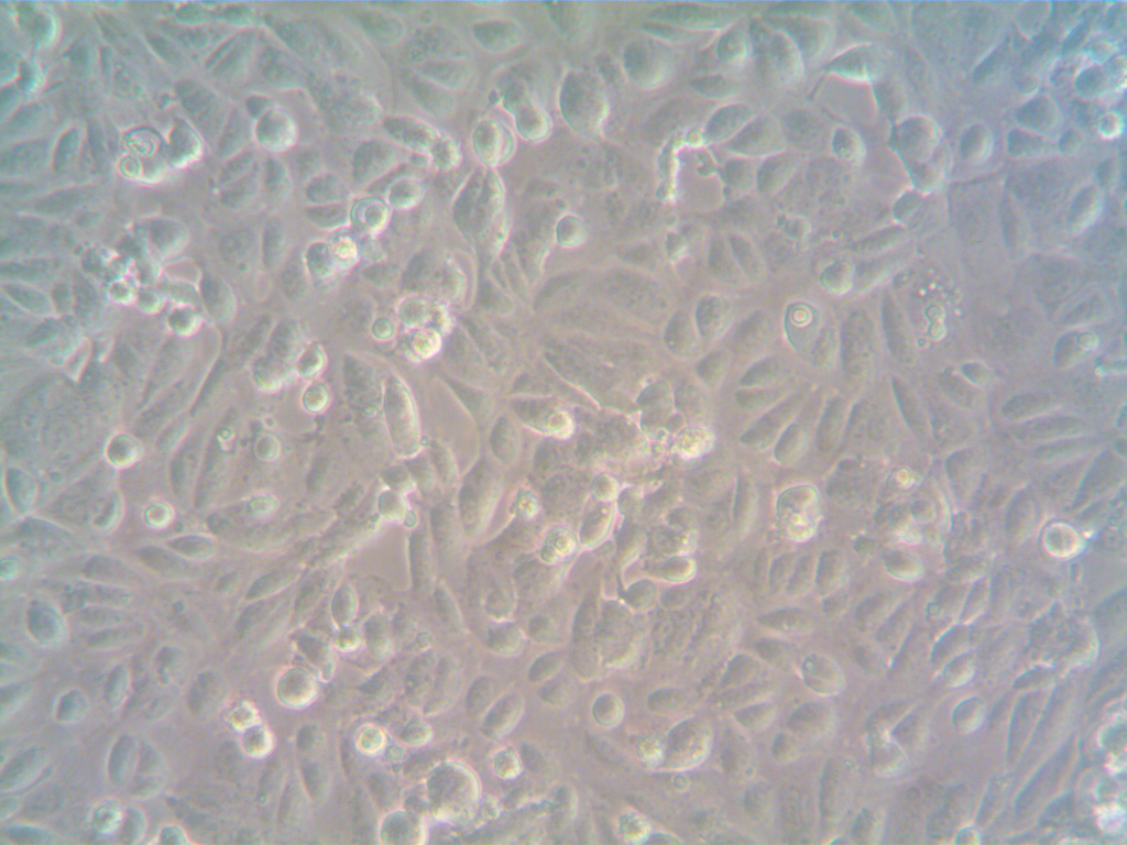 Human Ovarian Cancer-Associated Fibroblasts (CAF)