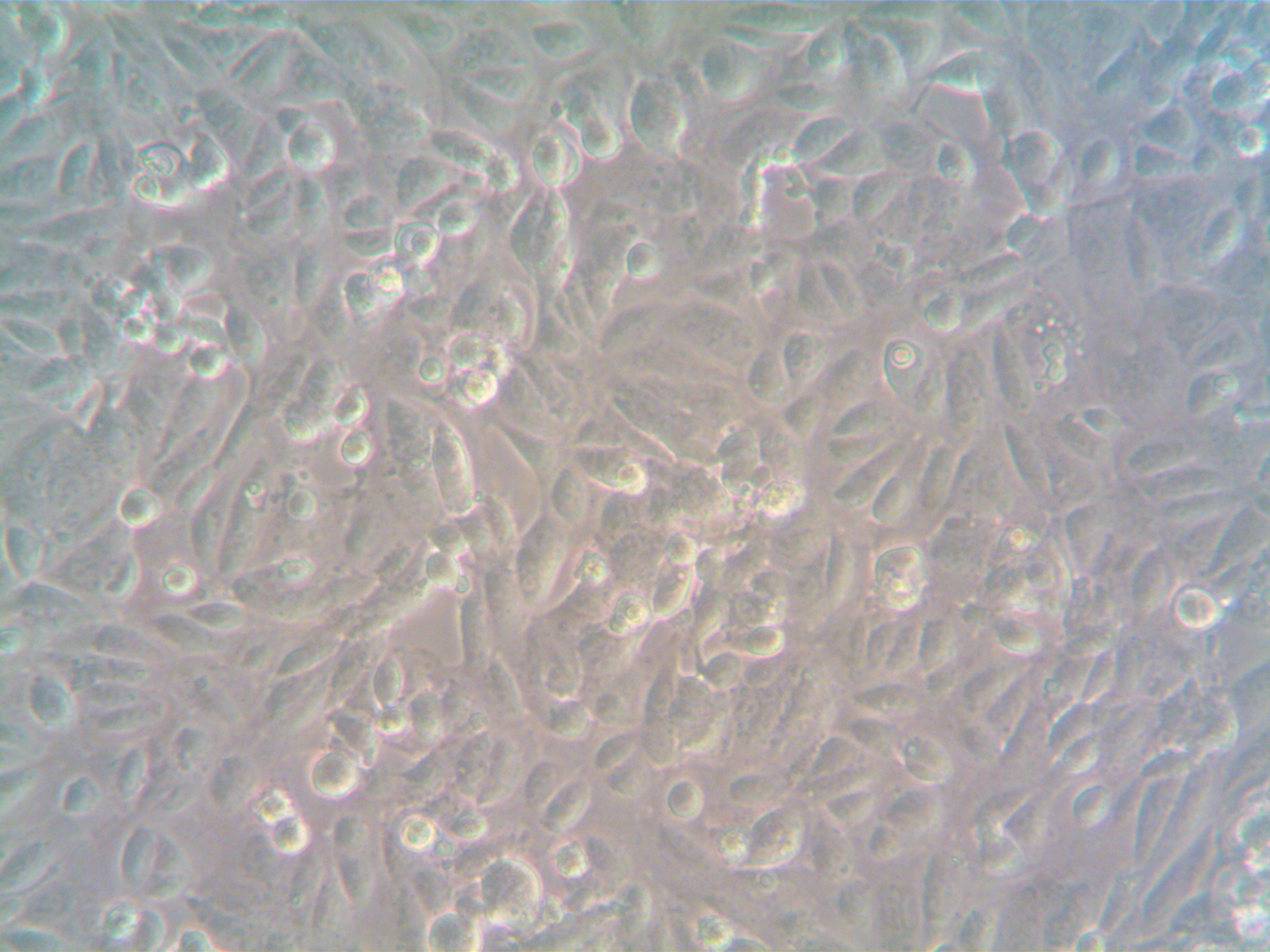 Human Ovarian Cancer-Associated Fibroblasts (CAF)