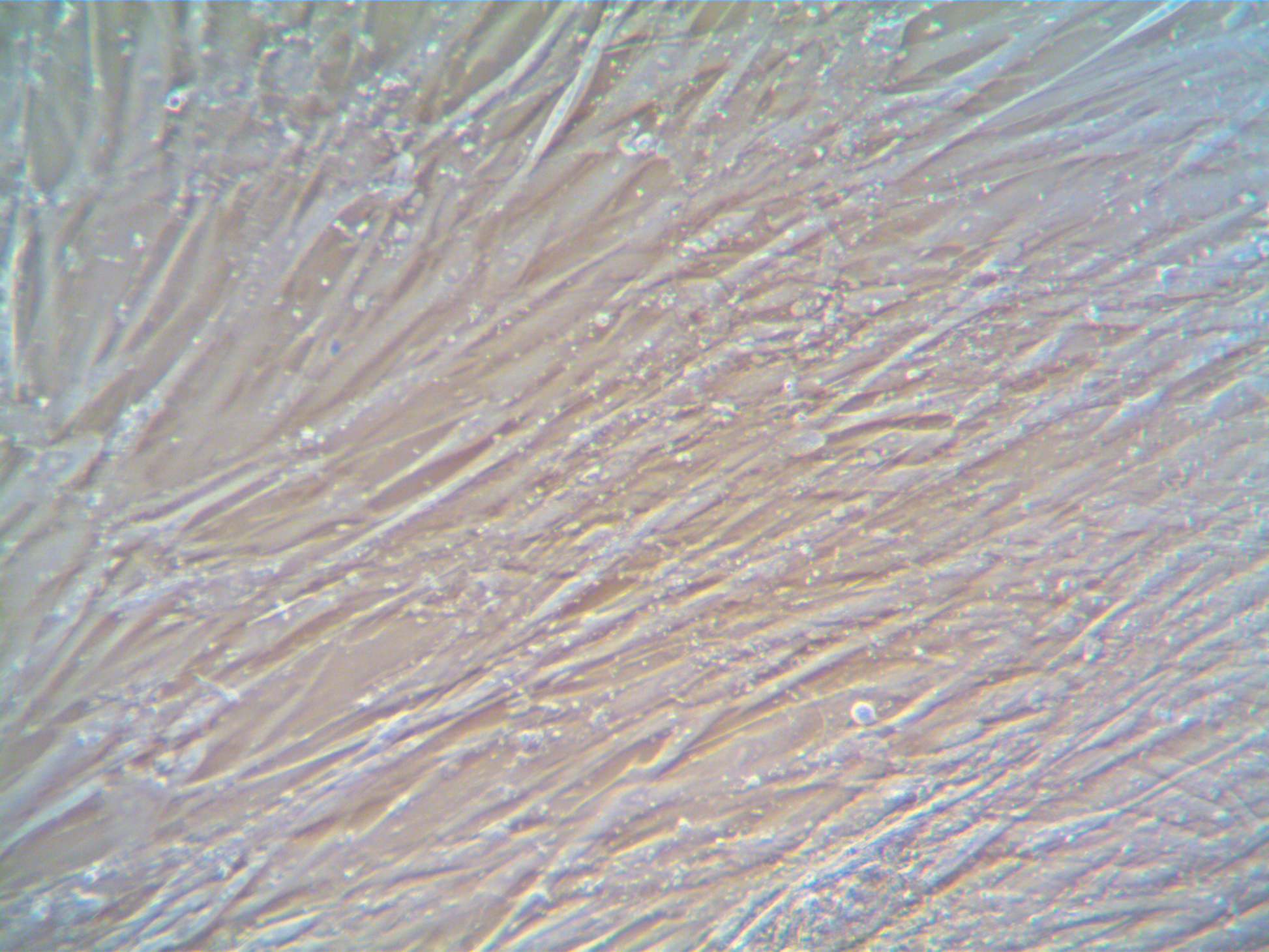 hTERT Human Lung Cancer-Associated Fibroblasts (CAF) – Squamous Cell Carcinoma