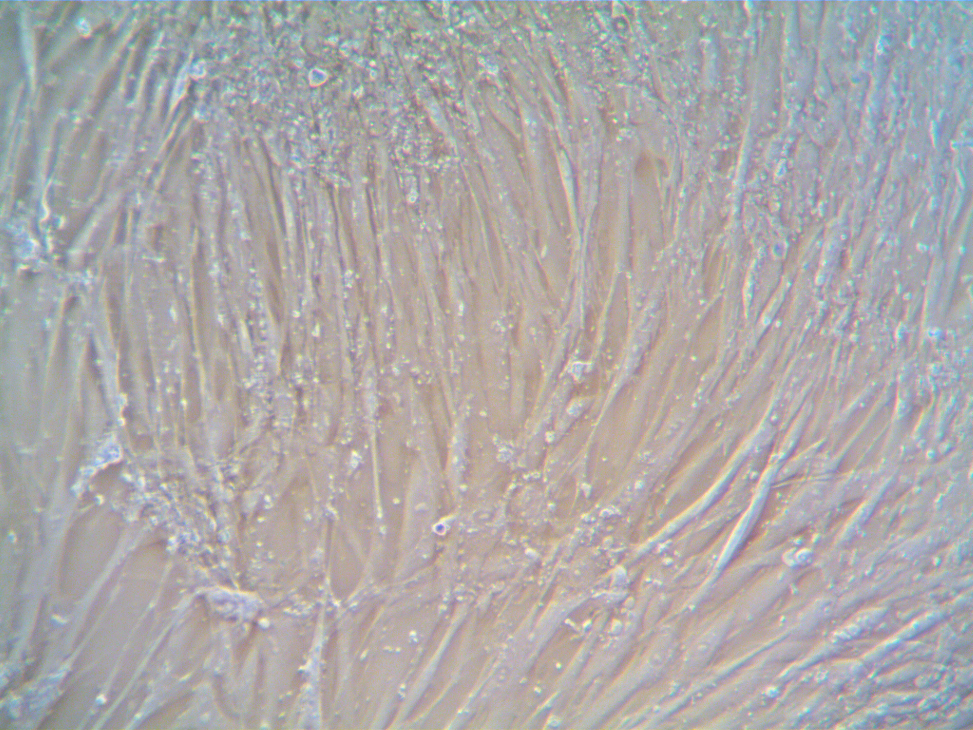 Human Lung Cancer-Associated Fibroblasts (CAF) – Squamous Cell Carcinoma